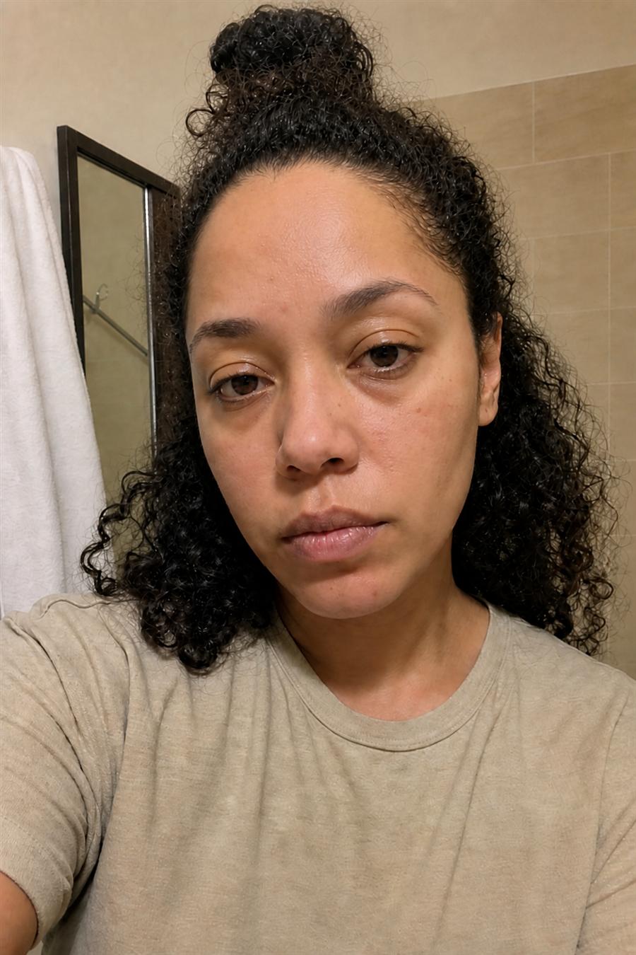 After using VYRELLE tallow cream